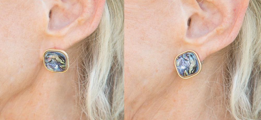 Hypoallergenic Earring Lifts