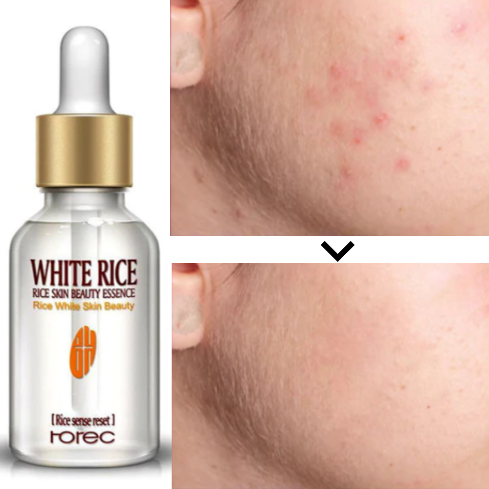 White Rice Serum