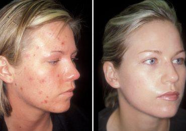White Rice Serum